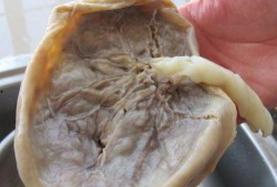 四个月胎盘吃瓜,孕育生命的奇妙旅程