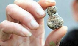 肾结石吃哪些瓜,这些瓜类食物助你排石养肾